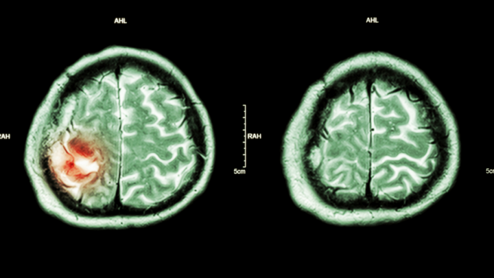 A brain tumor is the most severe reason why a do might rub its face constantly